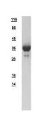 Human CRALBP protein, His tag. GTX109228-pro