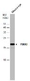 Anti-PDE6D antibody [N1C3] used in Western Blot (WB). GTX109240