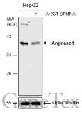 Anti-Arginase 1 antibody used in Western Blot (WB). GTX109242