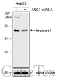 Anti-Arginase 1 antibody used in Western Blot (WB). GTX109242