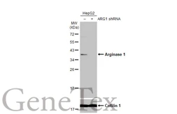 Anti-Arginase 1 antibody used in Western Blot (WB). GTX109242
