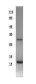 Human FABP3 protein, His tag. GTX109243-pro