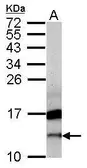Anti-CRIPT antibody [N1C3] used in Western Blot (WB). GTX109246