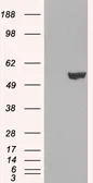 Anti-IRF6 antibody, C-term used in Western Blot (WB). GTX10925