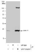 Anti-GSTT1 antibody used in Immunoprecipitation (IP). GTX109250