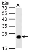 Anti-GSTT1 antibody used in Western Blot (WB). GTX109250