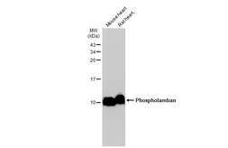 Anti-Phospholamban antibody used in Western Blot (WB). GTX109254
