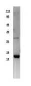 Human UBE2D1 protein, His tag. GTX109257-pro