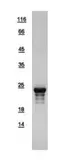 Human Adrenomedullin protein, His tag. GTX109260-pro