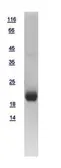 Human Telethonin protein, His tag. GTX109265-pro