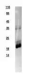 Human RAC3 protein, His tag. GTX109266-pro