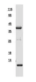 Human Tropomyosin 2 protein, His tag. GTX109268-pro