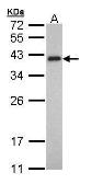 Anti-Tropomyosin 2 antibody [N1C3] used in Western Blot (WB). GTX109268