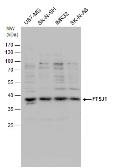 Anti-FTSJ1 antibody used in Western Blot (WB). GTX109271