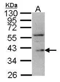 Anti-DUSP12 antibody [N1N3] used in Western Blot (WB). GTX109287