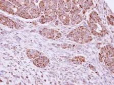 Anti-DUSP7 antibody [C1C3] used in IHC (Paraffin sections) (IHC-P). GTX109289
