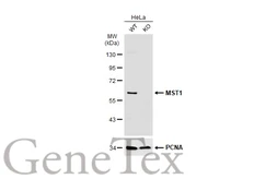 Anti-MST1 antibody used in Western Blot (WB). GTX109294