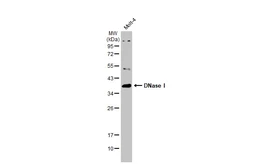Anti-DNase I antibody [N1C3] used in Western Blot (WB). GTX109306