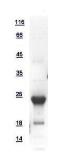Human SelS protein, His tag. GTX109311-pro