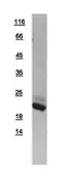 Human AP1S2 protein, His tag. GTX109314-pro