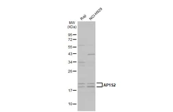 Anti-AP1S2 antibody used in Western Blot (WB). GTX109314