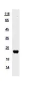 Human XG protein, His tag. GTX109316-pro