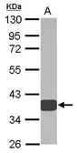 Anti-AKR1D1 antibody used in Western Blot (WB). GTX109328