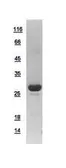 Human Cardiac Troponin I protein, His tag. GTX109331-pro