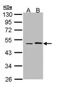 Anti-EPHX1 antibody used in Western Blot (WB). GTX109360