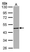 Anti-TBX19 antibody [N1C1] used in Western Blot (WB). GTX109384