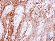 Anti-UBE4B antibody [C2C3], C-term used in IHC (Paraffin sections) (IHC-P). GTX109385