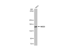 Anti-NSD3 antibody [C1C2], Internal used in Western Blot (WB). GTX109396