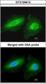 Anti-CCDC83 antibody [N1C2] used in Immunocytochemistry/ Immunofluorescence (ICC/IF). GTX109413