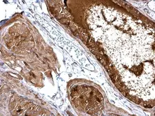 Anti-MAP3K14 antibody used in IHC (Paraffin sections) (IHC-P). GTX109419