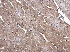 Anti-SLC25A15 antibody [N1C3-2] used in IHC (Paraffin sections) (IHC-P). GTX109432