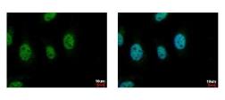 Anti-CDC45L antibody [C1C3] used in Immunocytochemistry/ Immunofluorescence (ICC/IF). GTX109454