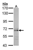 Anti-CDC45L antibody [C1C3] used in Western Blot (WB). GTX109454