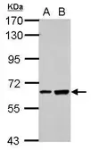 Anti-SPATA16 antibody used in Western Blot (WB). GTX109460