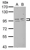 Anti-FXR2 antibody used in Western Blot (WB). GTX109465