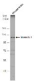 Anti-SmarcAL1 antibody used in Western Blot (WB). GTX109468