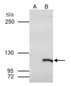 Anti-SmarcAL1 antibody used in Immunoprecipitation (IP). GTX109468