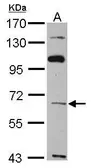 Anti-TBX4 antibody [C1C3] used in Western Blot (WB). GTX109470