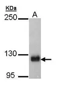 Anti-SCAP antibody [C2C3], C-term used in Western Blot (WB). GTX109474