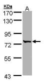 Anti-BBS10 antibody [N2C1], Internal used in Western Blot (WB). GTX109475