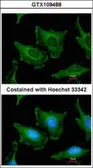 Anti-SEC23A antibody [N1C1] used in Immunocytochemistry/ Immunofluorescence (ICC/IF). GTX109488