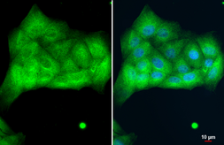 Anti-Cytokeratin 8 antibody [N1N3] used in Immunocytochemistry/ Immunofluorescence (ICC/IF). GTX109489