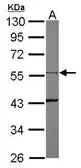 Anti-Cytokeratin 8 antibody [N1N3] used in Western Blot (WB). GTX109489