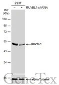 Anti-RUVBL1 antibody used in Western Blot (WB). GTX109494