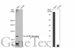 Anti-GCSF Receptor antibody [N2C1], Internal used in Western Blot (WB). GTX109503