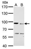 Anti-MAD1 antibody used in Western Blot (WB). GTX109519